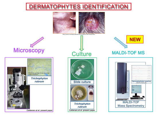 Dermatophyte Infections Identification