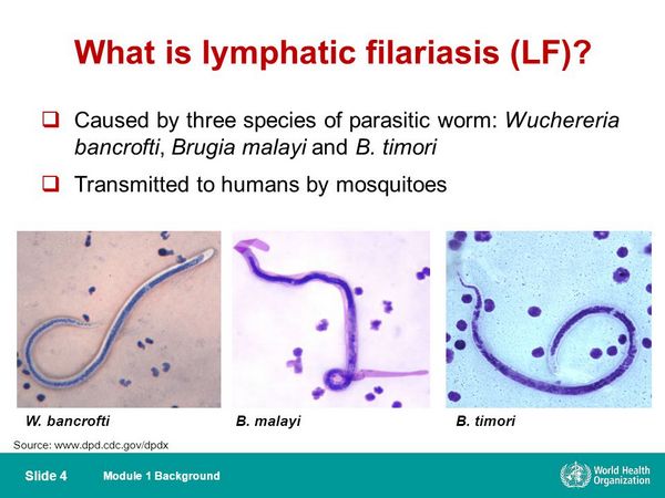 Filariasis (Wuchereria Bancrofti and Brugia Malayi)