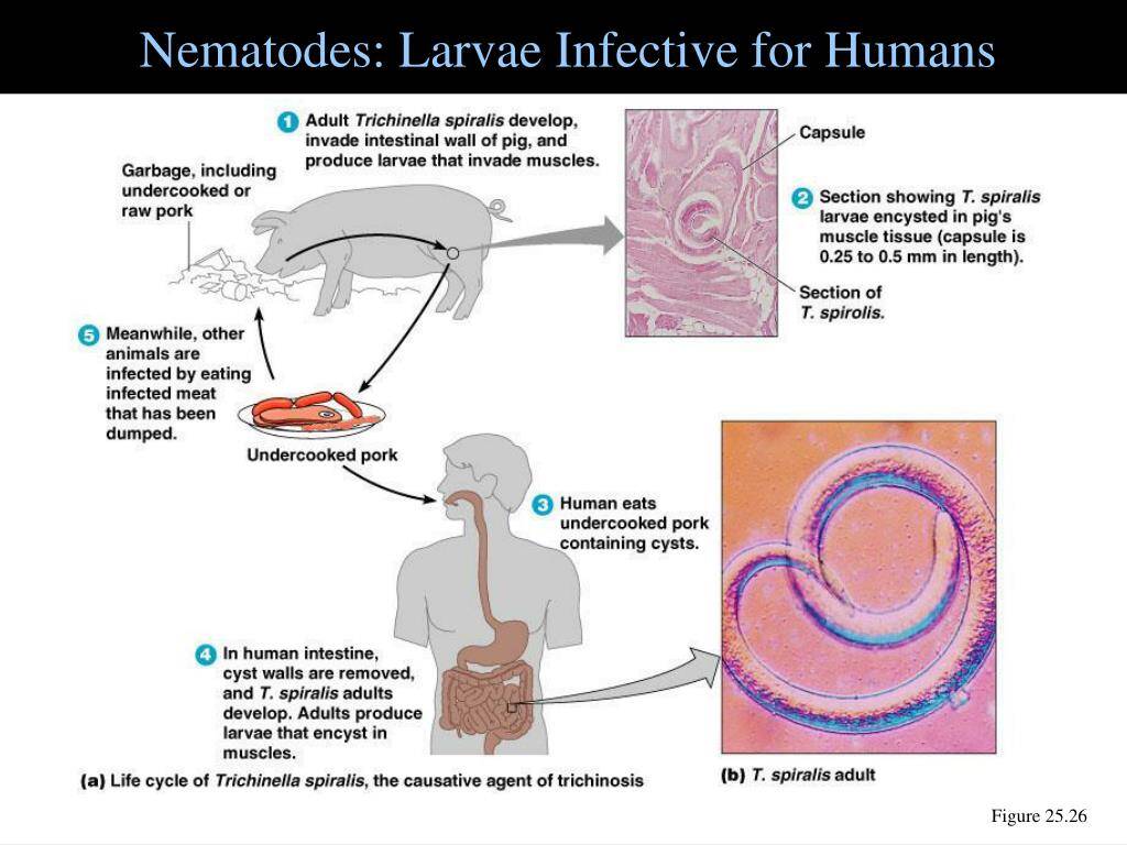 Nematode larvae infective for humans