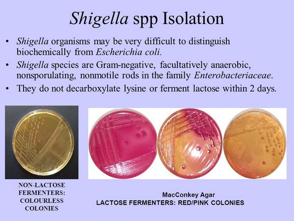 Shigella species