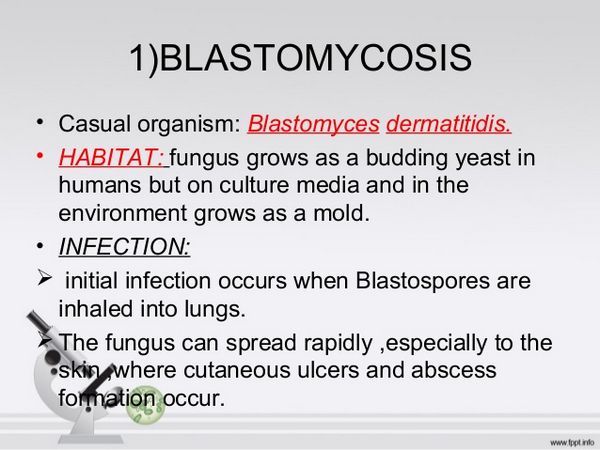 Ketoconazole for blastomycosis